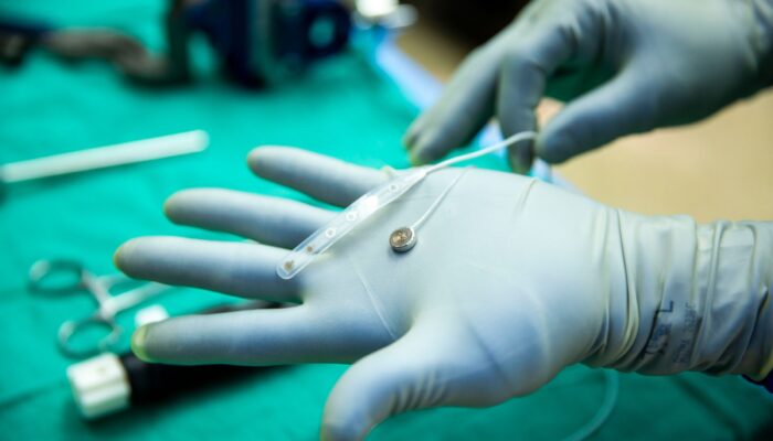 a-neuralink-rival-just-tested-a-brain-implant-in-a-person