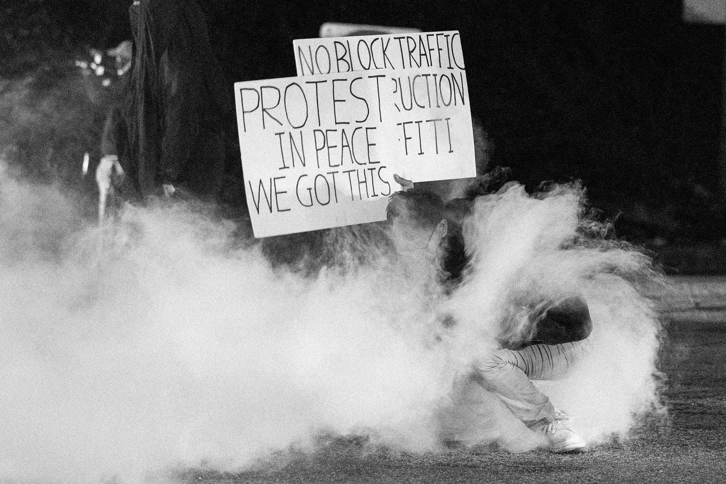what-tear-gas-and-rubber-bullets-do-to-the-human-body