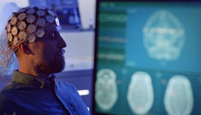 an-ai-model-for-the-brain-is-coming-to-the-icu