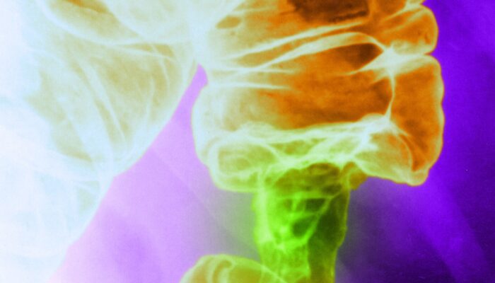 a-new-light-based-cancer-treatment-kills-tumor-cells-and-spares-healthy-ones