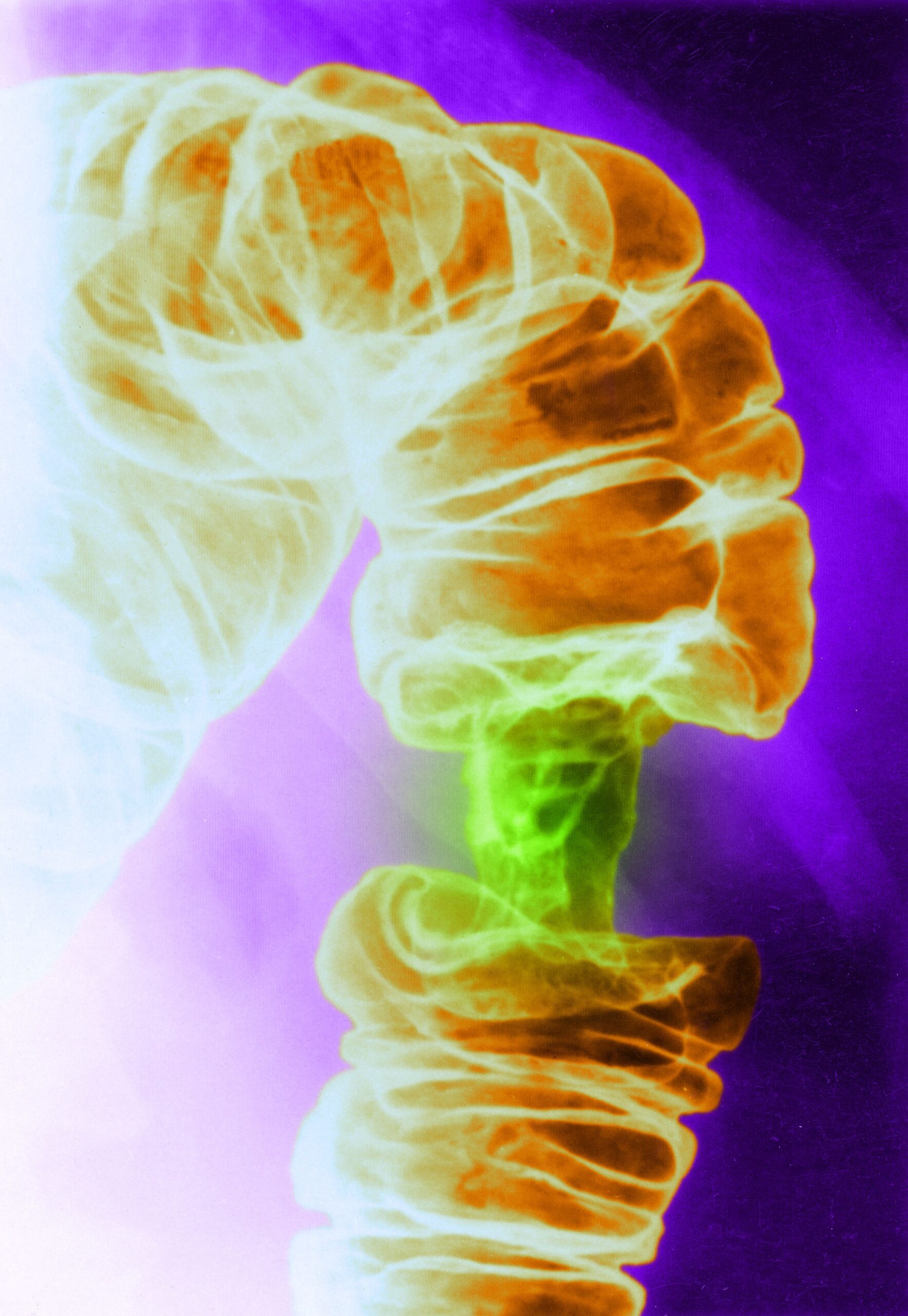 a-new-light-based-cancer-treatment-kills-tumor-cells-and-spares-healthy-ones a-new-light-based-cancer-treatment-kills-tumor-cells-and-spares-healthy-ones